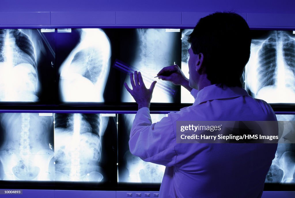 RADIOLOGIST EXAMINING X-RAYS ON LIGHT BOX