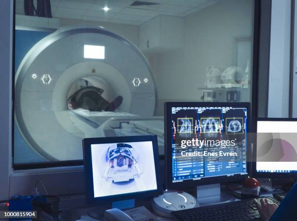 anciano con resonancia magnética - medical scanner fotografías e imágenes de stock