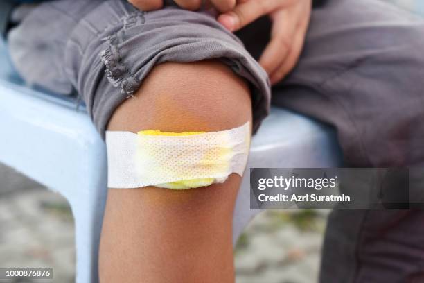 child knee with an adhesive bandage. - healing wound stock pictures, royalty-free photos & images