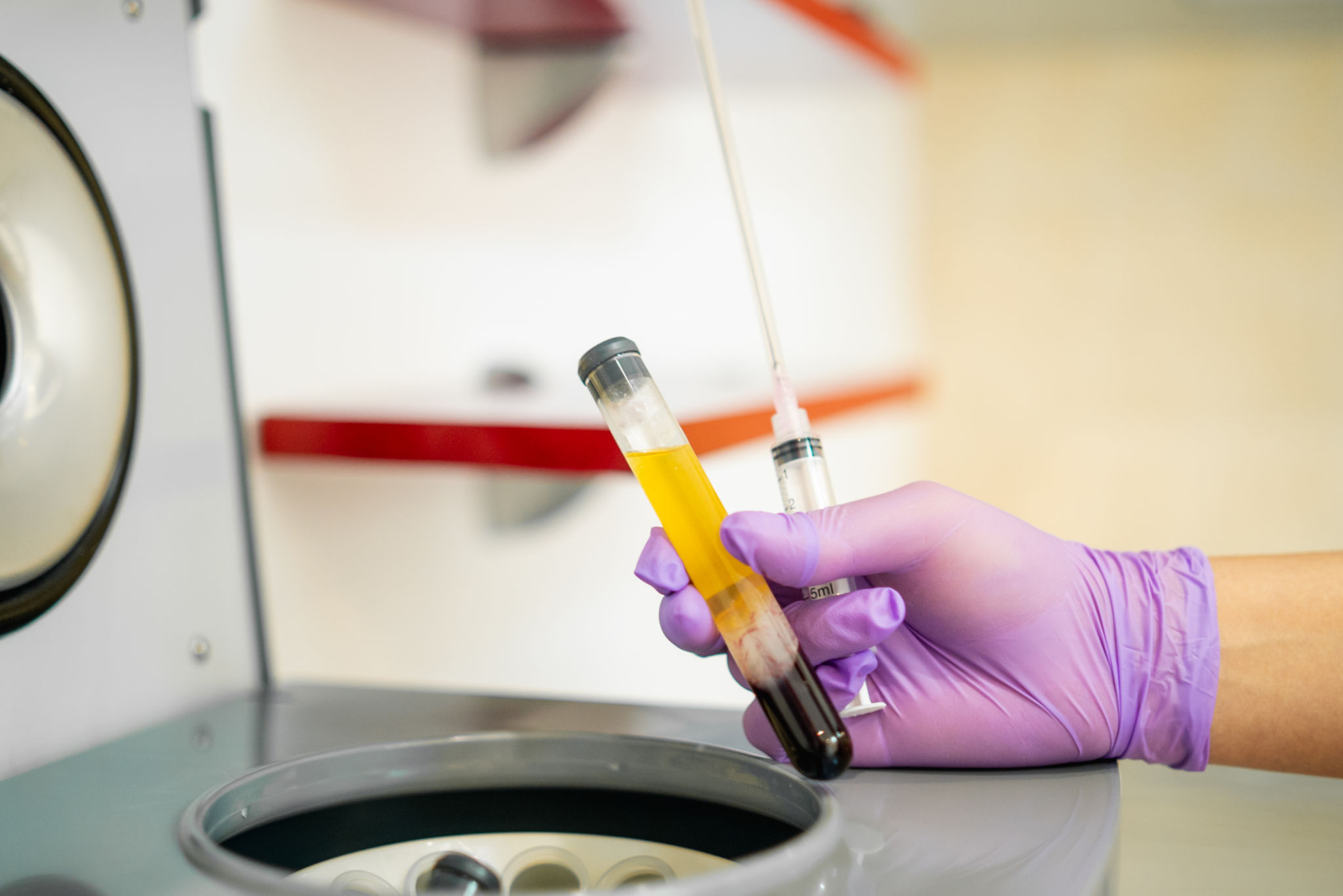 Preparing blood plasma for vampire treatment Preparing blood plasma for vampire treatment