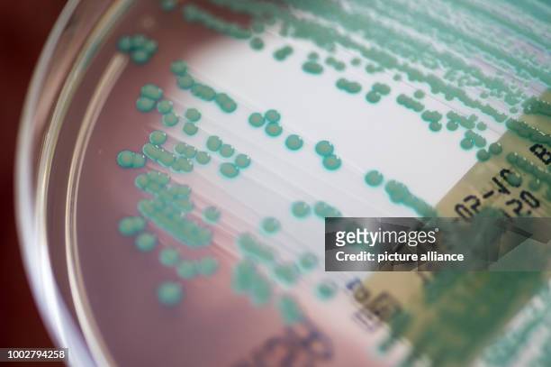 Picture of a petri dish with MRSA bacteria taken at the University Clinic in Regensburg, Germany, 10 April 2017. Schneider is Bavaria's...