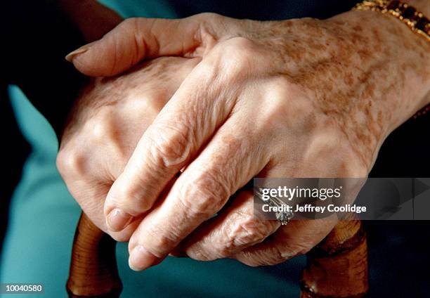 elderly woman's hands - keratosis stock-fotos und bilder