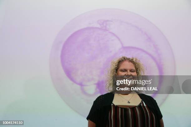 Louise Brown, who in 1978 became the world's first baby to be born following successful in vitro fertilisation , poses in front of a projection...