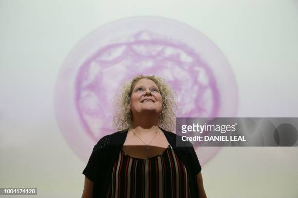 Louise Brown, who in 1978 became the world's first baby to be born following successful in vitro fertilisation , poses in front of a projection...