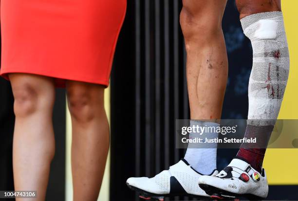 Podium / Philippe Gilbert of Belgium and Team Quick-Step Floors Most combative rider / Injury / Legs / Detail view / during the 105th Tour de France...