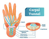 Carpal tunnel vector illustration scheme. Medical labeled diagram closeup with muscle, transverse carpal ligament, median nerve, tendon sheath, flextor tendons and bones.