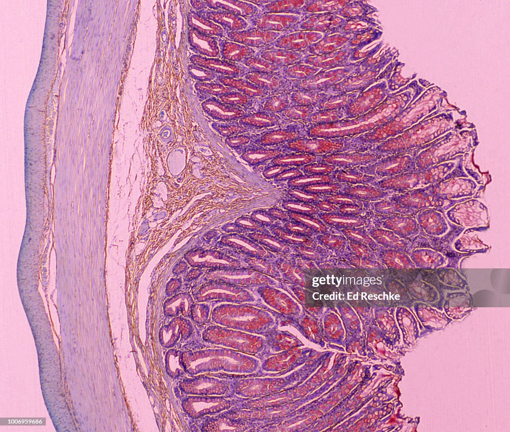 LARGE INTESTINE (or Colon) shows the Mucosa, Submucosa, Muscularis, Serosa and Many Goblet Cells. 10X