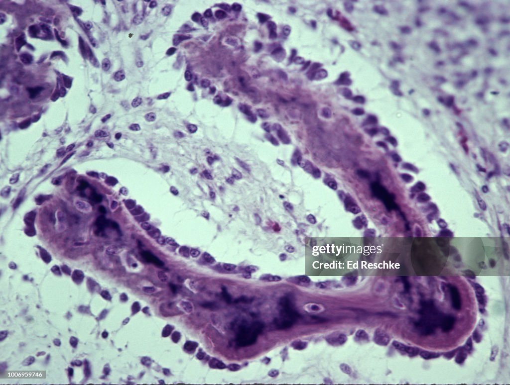 OSTEOBLASTS and OSTEOCYTES in developing INTRAMEMBRANOUS (or Membrane) BONE, INTRAMEMBRANOUS OSSIFICATION, 100x