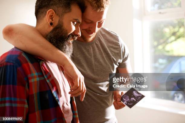 Affectionate male gay couple looking at ultrasound photo