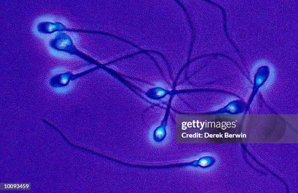 medical, human spermatozoa - sperm stock pictures, royalty-free photos & images