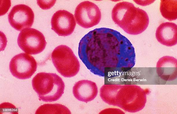 red blood cells surround white cell - color realzado fotografías e imágenes de stock