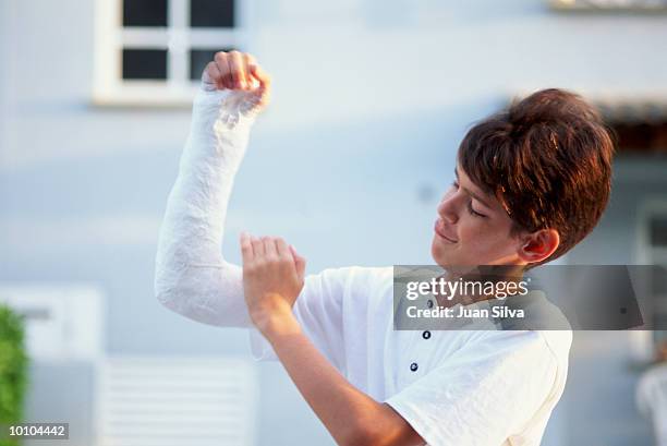 young boy with arm in cast - boy broken arm stock pictures, royalty-free photos & images