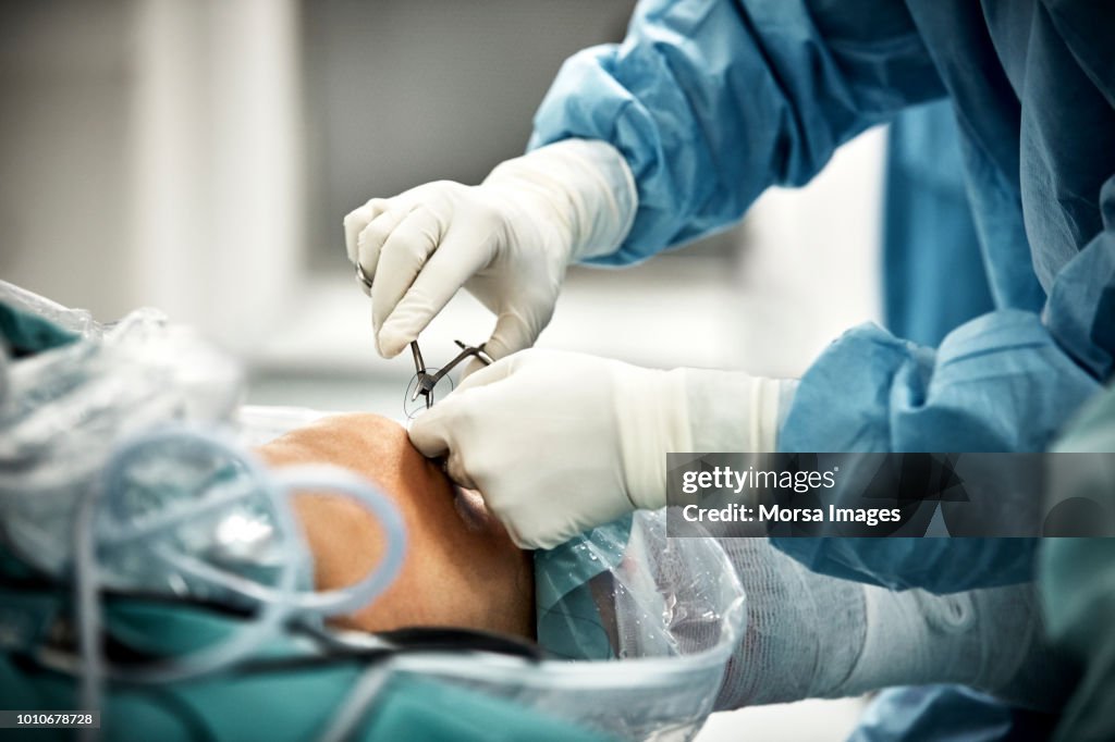 Cropped Hands Of Surgeon Stitching After Arthroscopic Surgery High-Res ...