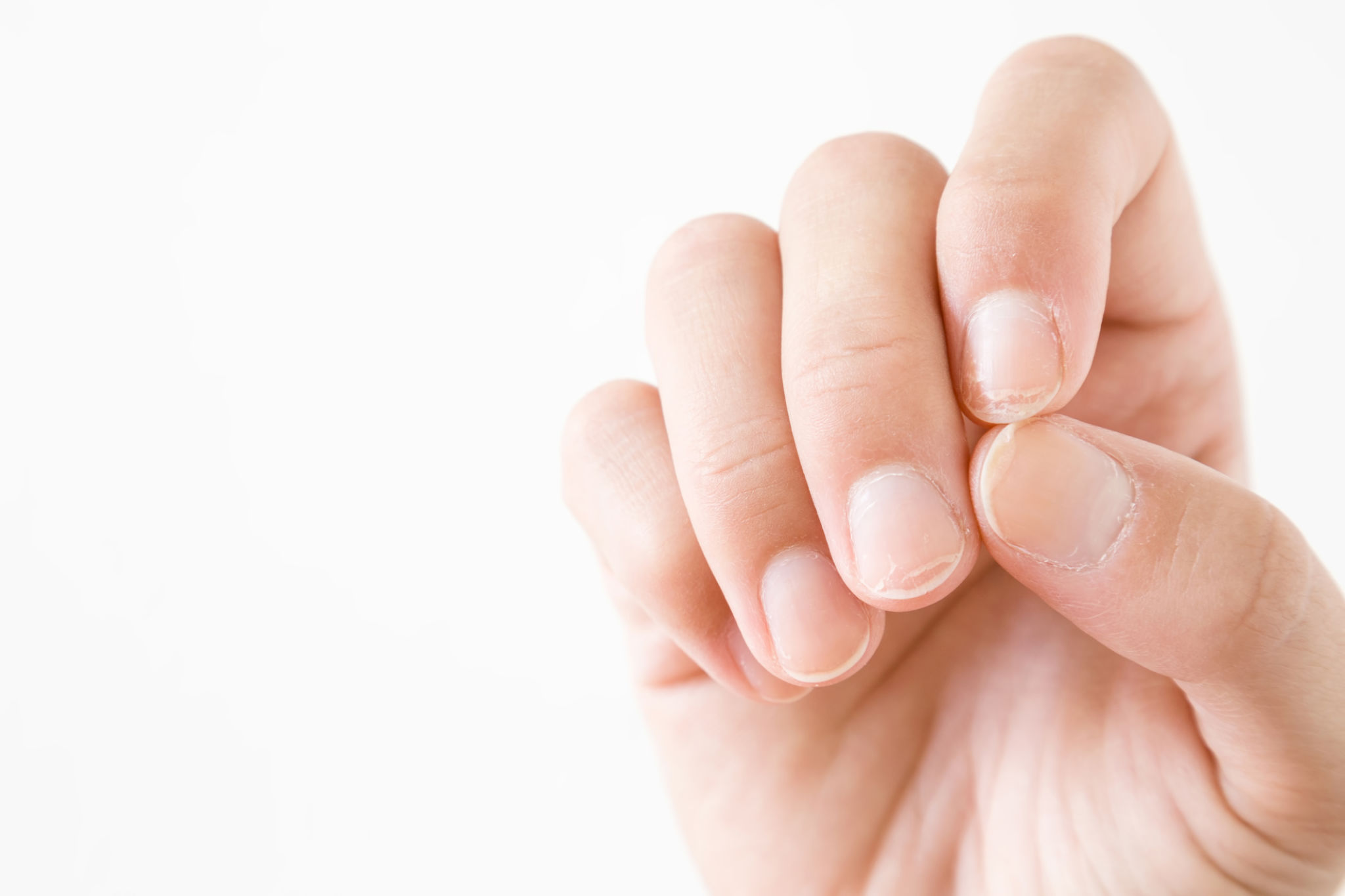 nail hygiene