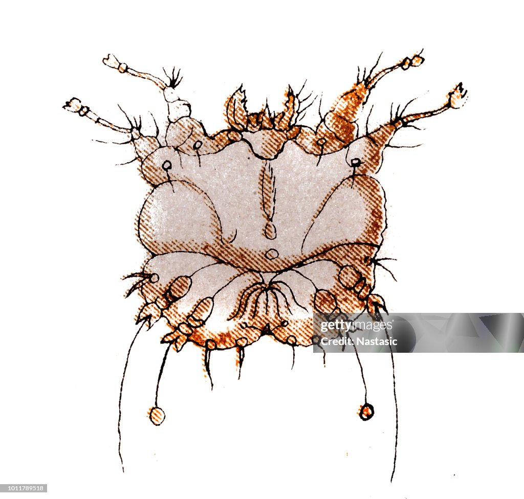 Scabies, also known as the seven-year itch, is a contagious skin infestation by the mite Sarcoptes scabiei