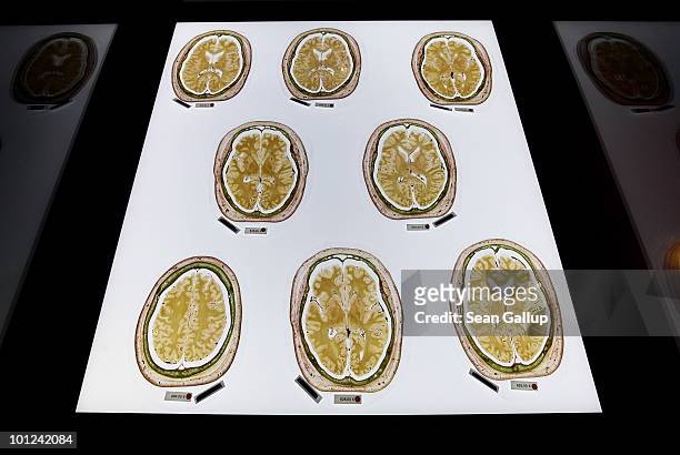 Plastinated slices of the human brain, marked with red dots to indicate that only institutions may buy them, lie on display for sale for up to EUR...