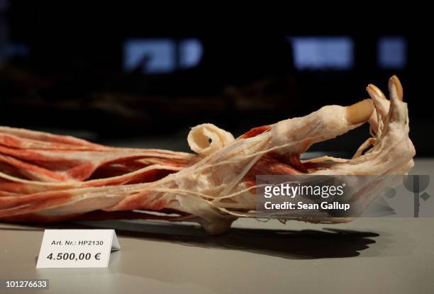 Plastinated human arm, which may only be purchased by institutions, lies for sale at the shop of the Plastinarium on May 28, 2010 in Guben, Germany....