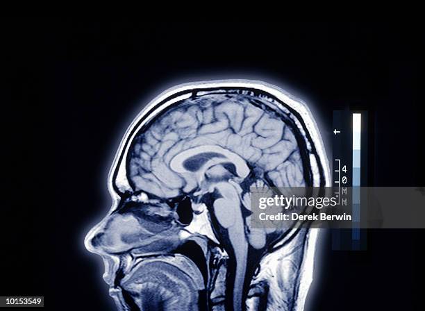mri image of male head - mri scan stock pictures, royalty-free photos & images