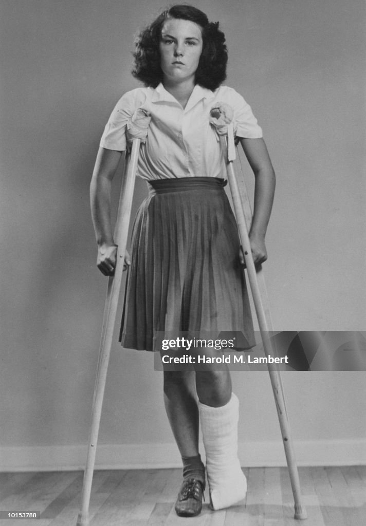GIRL STANDS WITH CAST ON LEG
