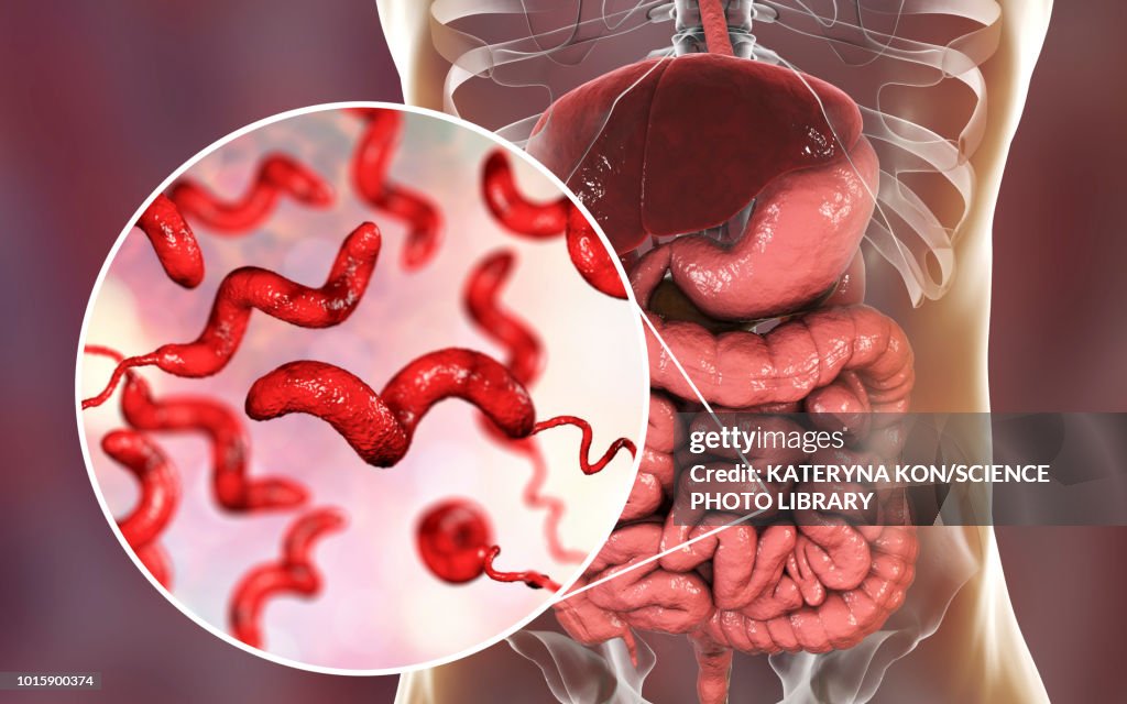 Campylobacteriosis, conceptual illustration