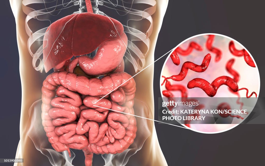 Campylobacteriosis, conceptual illustration