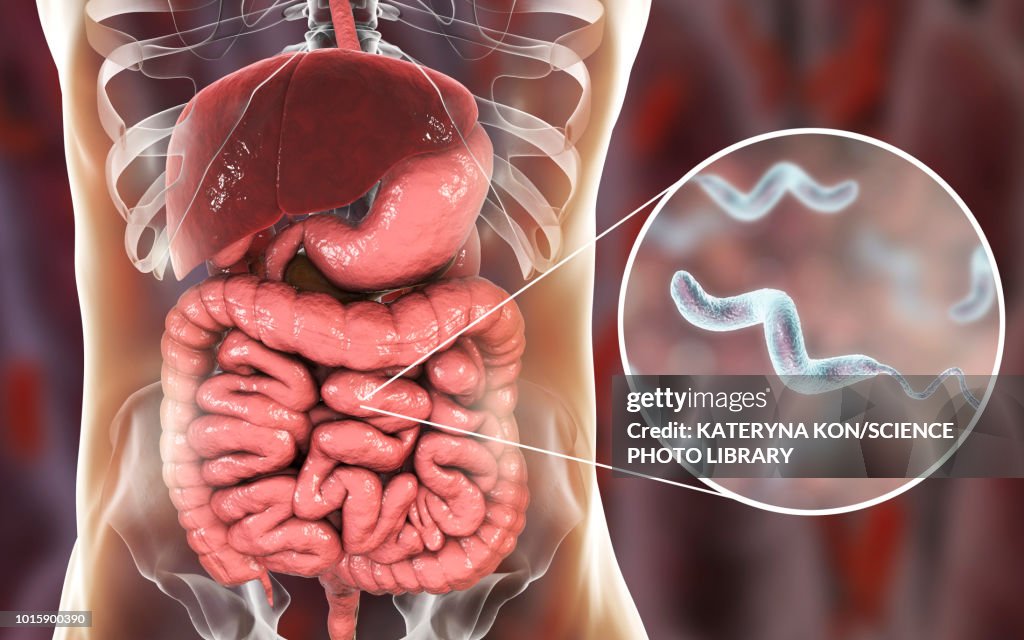 Campylobacteriosis, conceptual illustration