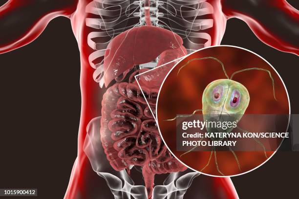 giardia lamblia in human duodenum, illustration - bloating stock illustrations