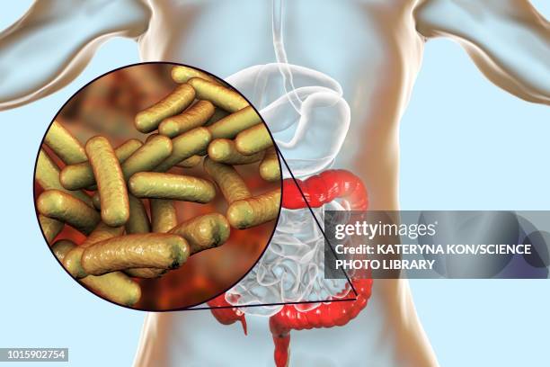 stockillustraties, clipart, cartoons en iconen met shigellosis, illustration - celmembraan