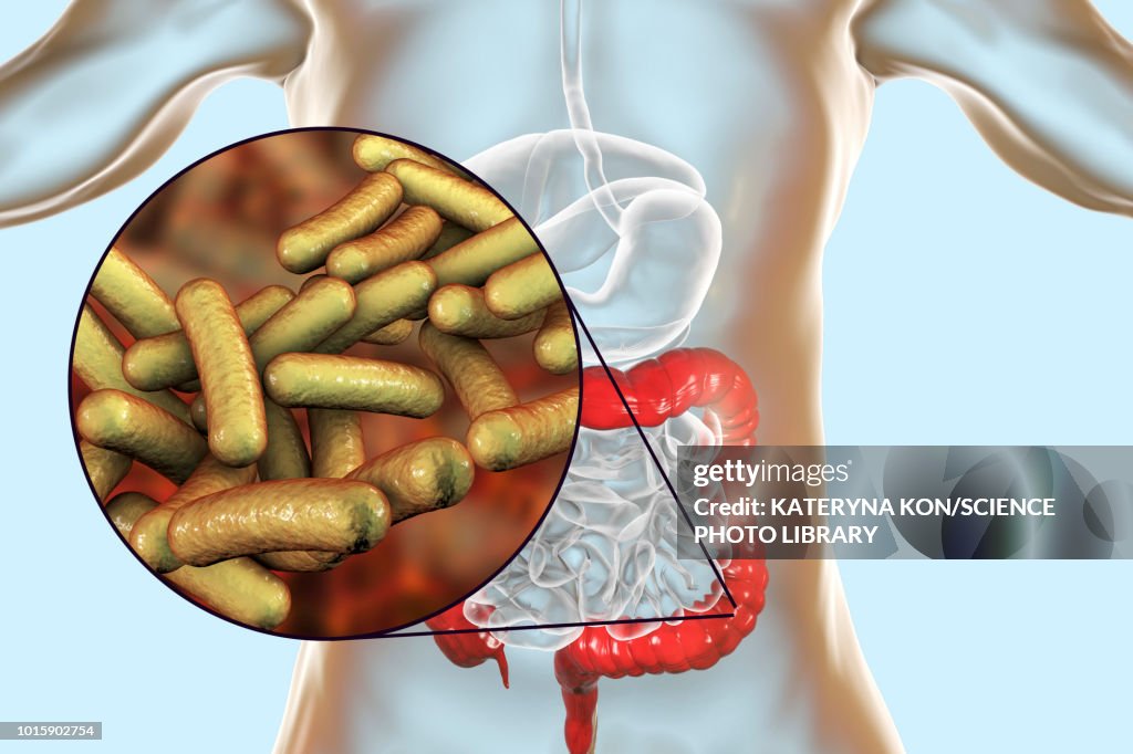 Shigellosis, illustration