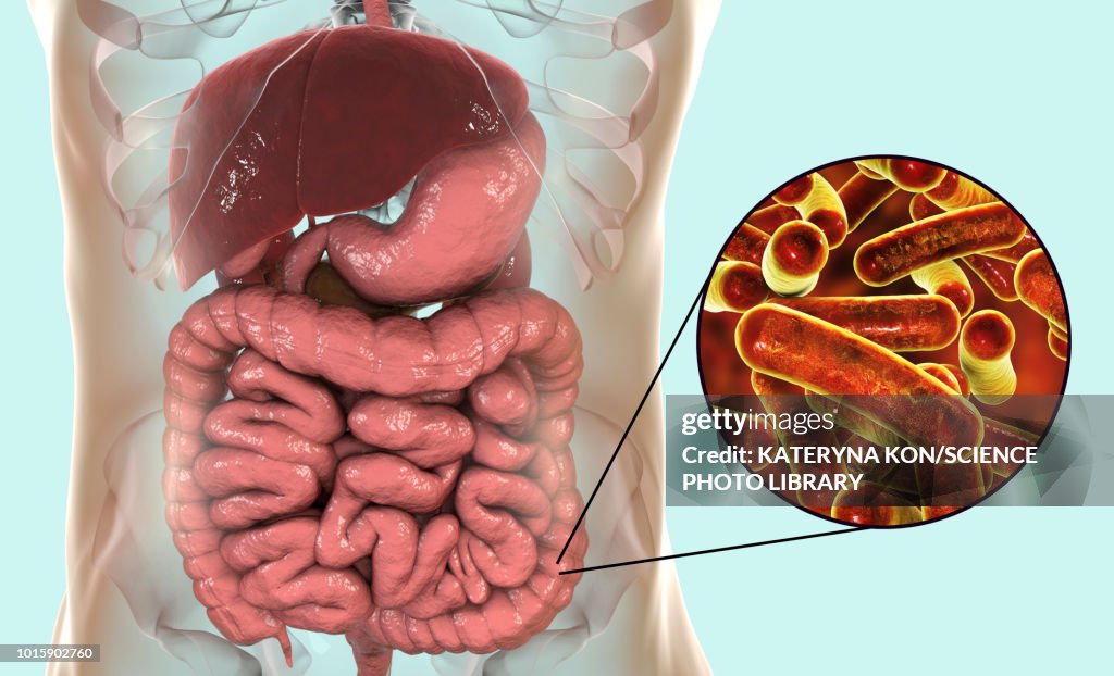 Shigellosis, illustration