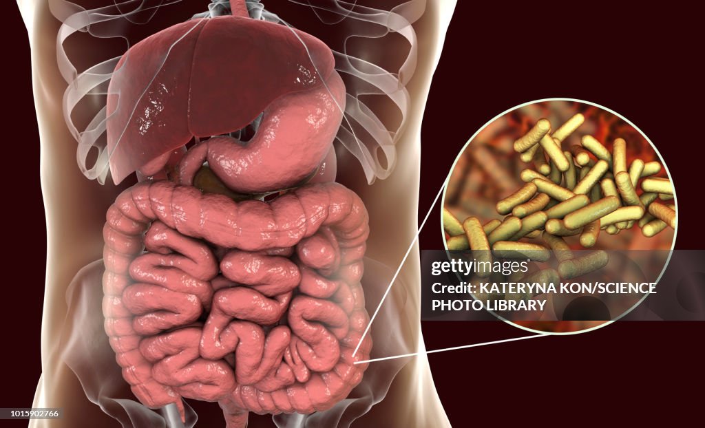 Shigellosis, illustration