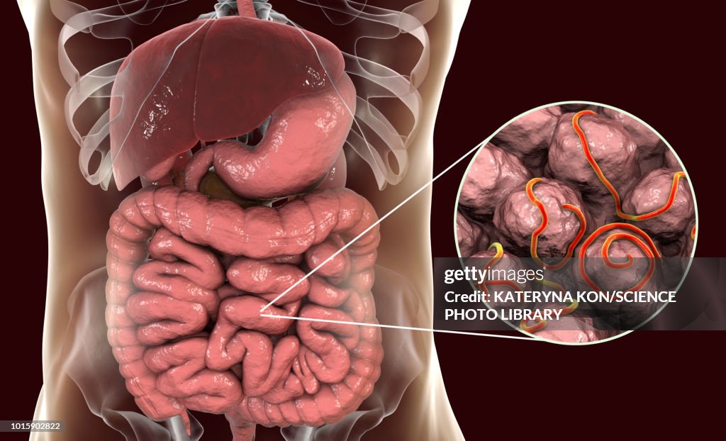 Threadworm Pathogenesis Threadworm In Humans