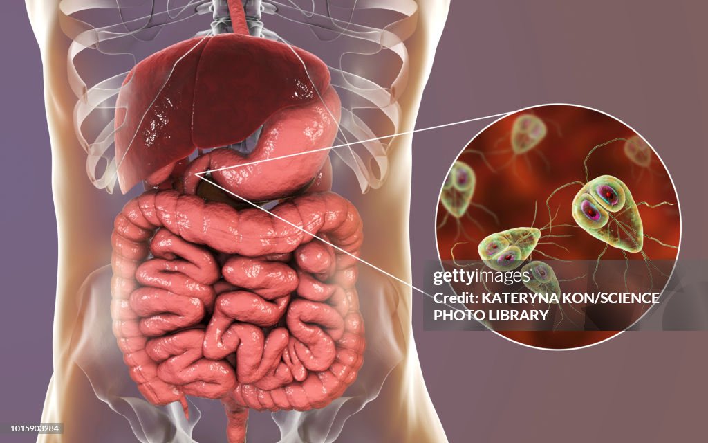 Giardia lamblia in human duodenum, illustration