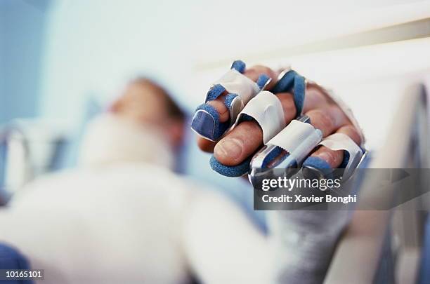 man in body cast, hand in brace - injured man in hospital bed stockfoto's en -beelden