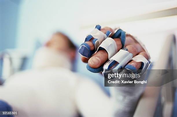 man in body cast, hand in brace - cast stockfoto's en -beelden