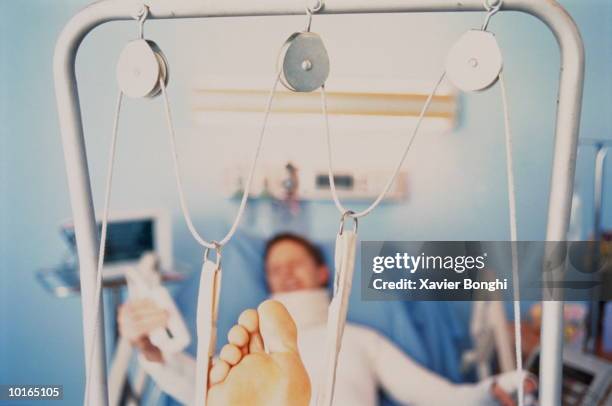 man in body cast, foot in traction - traction stock pictures, royalty-free photos & images