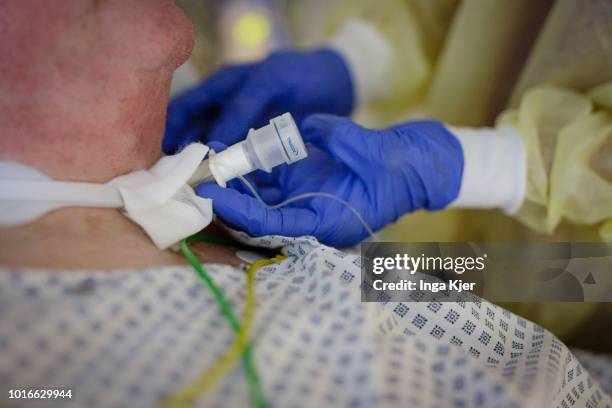 July 30: A medical doctor lays a respiratory aditus onto the throat of a patient in a intensive care unit on July 30, 2018 in Bad Belzig, Germany.