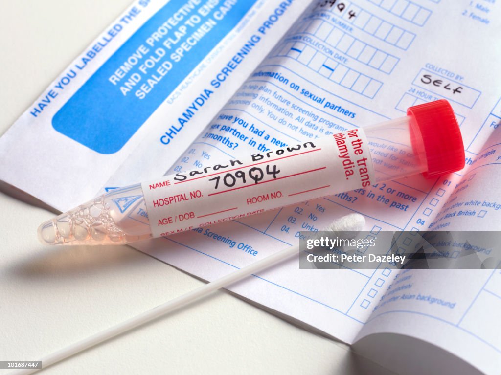 Chlamydia screening smear test
