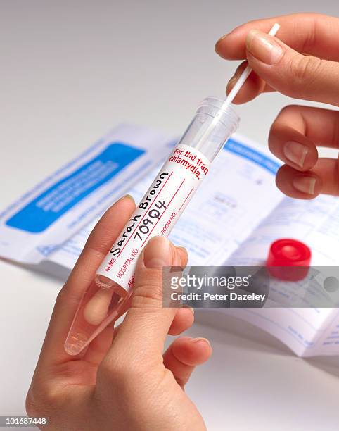 smear test for chlamydia  - pap smear 個照片及圖片檔