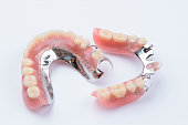 Removable metal partial denture on white background