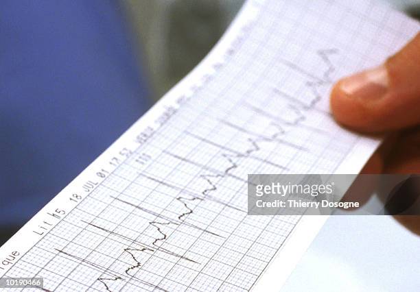 person holding electrocardiogram, close-up - pulse trace - fotografias e filmes do acervo