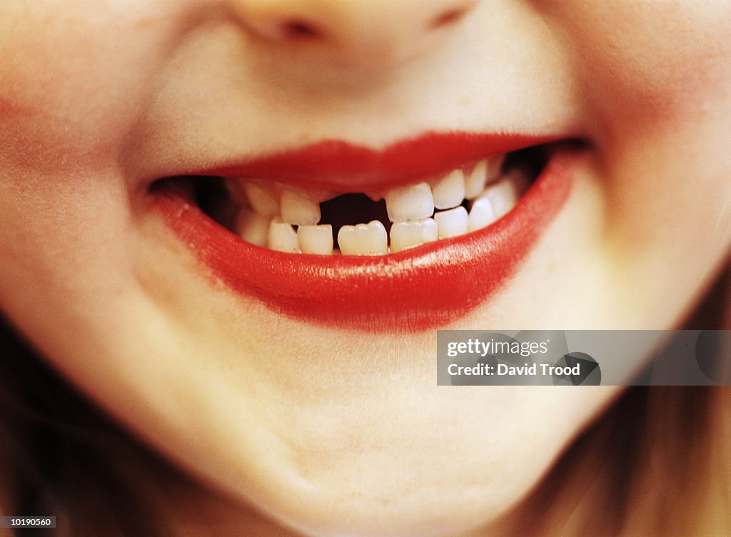 Girl (6-8) with missing front tooth, close-up