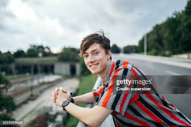 young man - acnes stock pictures, royalty-free photos & images