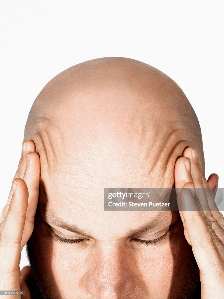 Bald man rubbing temples, headache