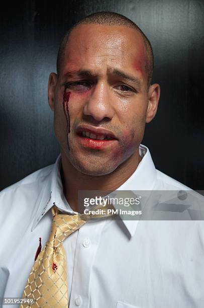 beat up businessman - victim stock-fotos und bilder