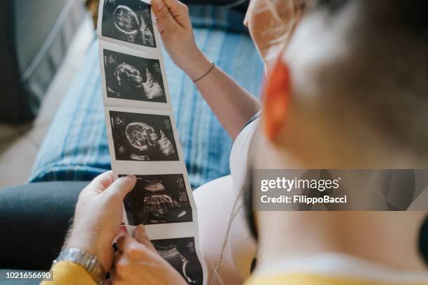 junges erwachsenes paar mit blick auf ultraschall ihres babys - ultrasound scan stock-fotos und bilder