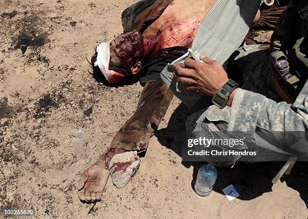 Gravely wounded Afghan man is attended to by a medic with the 82nd Airborne Division after a civilian truck hit a buried mine intended for the US...