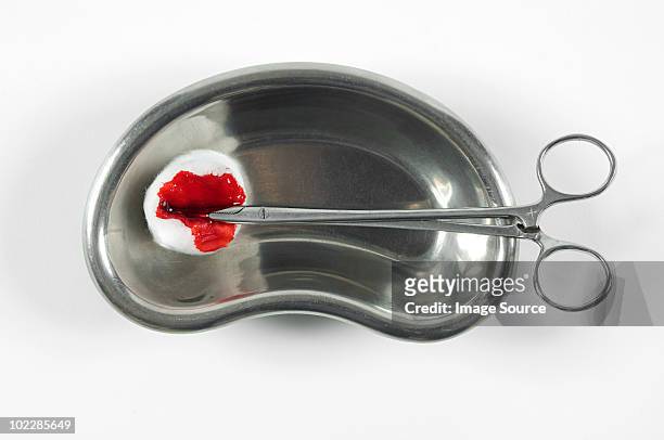 blood on cotton swab and surgical scissors - surgical tray stock pictures, royalty-free photos & images