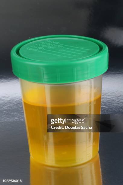 human urine sample in a sealed container for testing - a container for urine stock-fotos und bilder