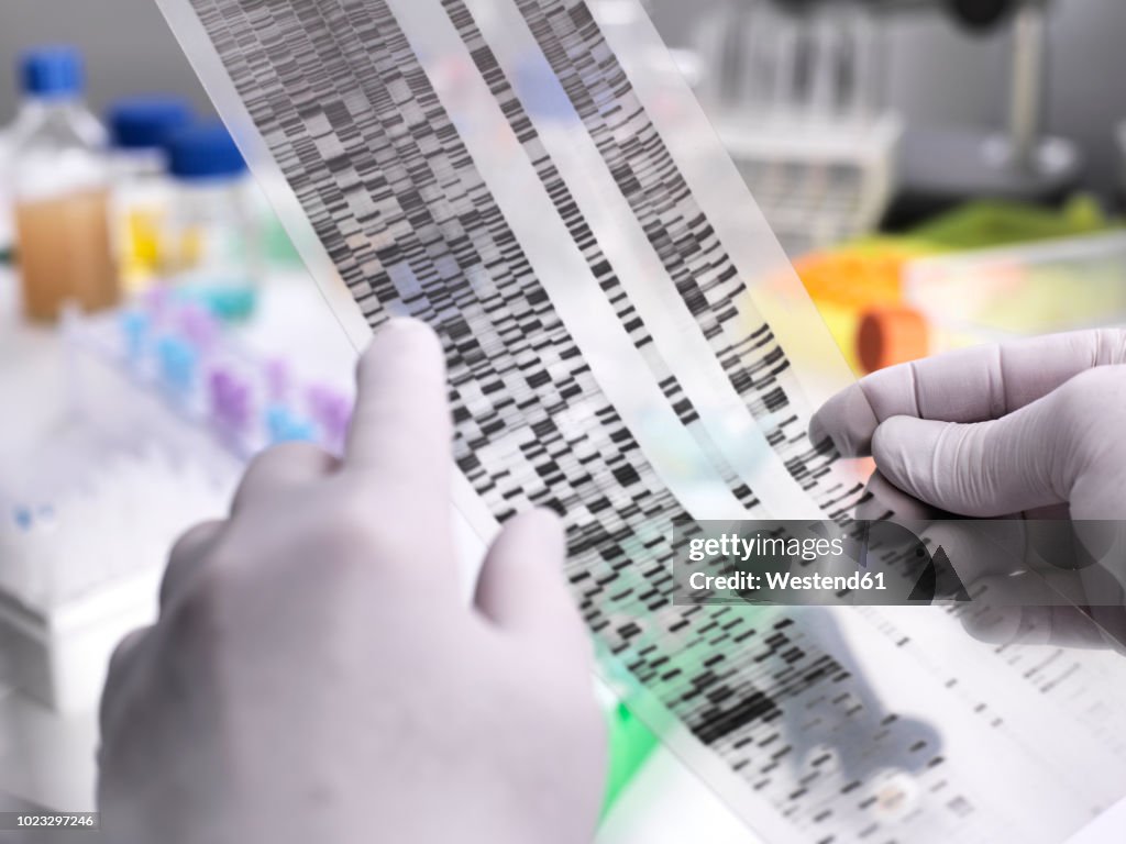 Genetic Research, Scientist holding a DNA gel revealing, the genetic make-up of the specimen